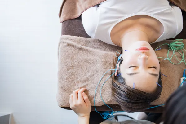 FN美容鍼を受けている女性の写真